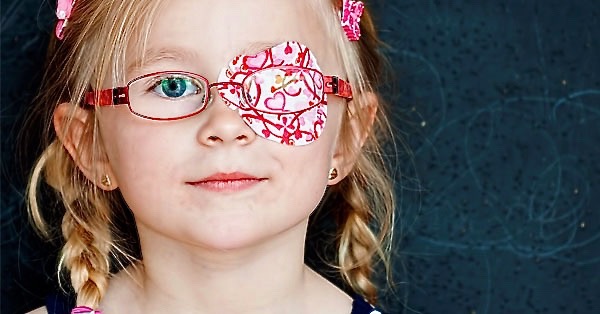 Ambliopía ¿Es necesaria la cirugía refractiva en niños?